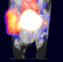 Simultaneous PET/MRI mouse tumor image - BIOTIC MIP using NuPET™