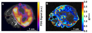 PET/MRI Images of A549 flank tumor in a mouse